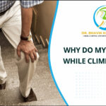 A man is struggling to climb stairs due to knee pain