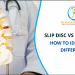 Difference between Slip Disc vs Muscle Pain
